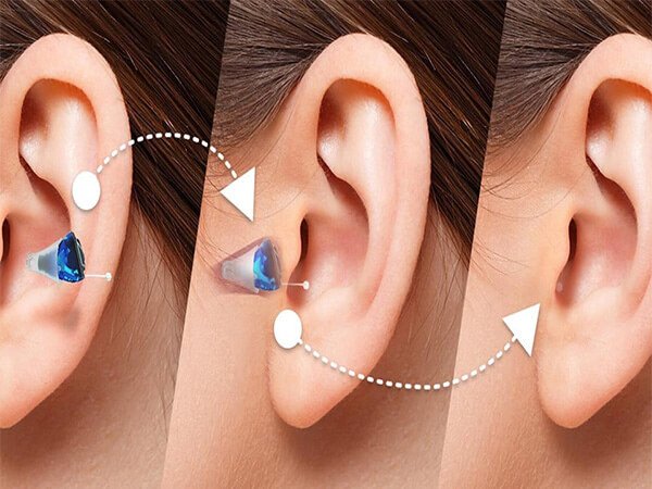 Range of modern hearing aids fitted at Prism Hearing, Pune